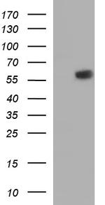 IRF5 Antibody in Western Blot (WB)