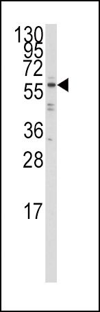 IRF5 Antibody in Western Blot (WB)