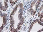 IRF6 Antibody in Immunohistochemistry (Paraffin) (IHC (P))