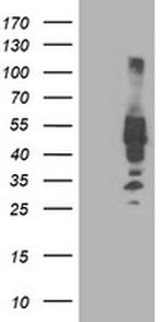 IRF6 Antibody in Western Blot (WB)