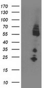IRF6 Antibody in Western Blot (WB)