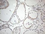 IRS1 Antibody in Immunohistochemistry (Paraffin) (IHC (P))