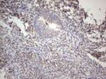 IRS1 Antibody in Immunohistochemistry (Paraffin) (IHC (P))