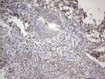 IRS1 Antibody in Immunohistochemistry (Paraffin) (IHC (P))