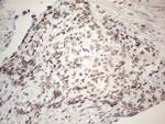 IRS1 Antibody in Immunohistochemistry (Paraffin) (IHC (P))