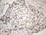 IRS1 Antibody in Immunohistochemistry (Paraffin) (IHC (P))
