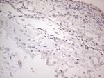 IRS1 Antibody in Immunohistochemistry (Paraffin) (IHC (P))