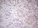 IRS1 Antibody in Immunohistochemistry (Paraffin) (IHC (P))