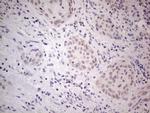 IRS1 Antibody in Immunohistochemistry (Paraffin) (IHC (P))