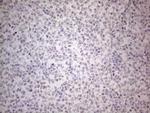IRS1 Antibody in Immunohistochemistry (Paraffin) (IHC (P))