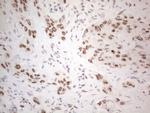 IRS1 Antibody in Immunohistochemistry (Paraffin) (IHC (P))