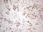 IRS1 Antibody in Immunohistochemistry (Paraffin) (IHC (P))