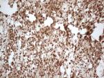 IRS1 Antibody in Immunohistochemistry (Paraffin) (IHC (P))