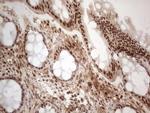 IRS1 Antibody in Immunohistochemistry (Paraffin) (IHC (P))