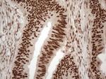 IRS1 Antibody in Immunohistochemistry (Paraffin) (IHC (P))