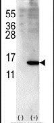 ISG15 Antibody in Western Blot (WB)