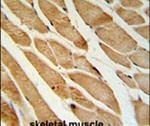 ISLR Antibody in Immunohistochemistry (IHC)