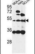 ISLR Antibody in Western Blot (WB)