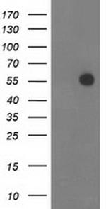 ITFG2 Antibody in Western Blot (WB)