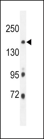 ITGA11 Antibody in Western Blot (WB)
