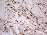 ITGAM Antibody in Immunohistochemistry (Paraffin) (IHC (P))