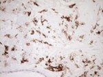 ITGAM Antibody in Immunohistochemistry (Paraffin) (IHC (P))