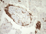 ITGAM Antibody in Immunohistochemistry (Paraffin) (IHC (P))