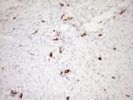 ITGAM Antibody in Immunohistochemistry (Paraffin) (IHC (P))