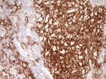 ITGAM Antibody in Immunohistochemistry (Paraffin) (IHC (P))
