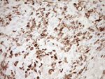 ITGAM Antibody in Immunohistochemistry (Paraffin) (IHC (P))