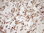 ITGAM Antibody in Immunohistochemistry (Paraffin) (IHC (P))