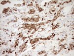 ITGAM Antibody in Immunohistochemistry (Paraffin) (IHC (P))