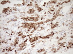 ITGAM Antibody in Immunohistochemistry (Paraffin) (IHC (P))