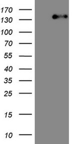 ITGAM Antibody in Western Blot (WB)