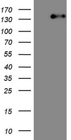 ITGAM Antibody in Western Blot (WB)