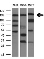 ITGAM Antibody in Western Blot (WB)