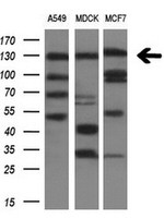ITGAM Antibody in Western Blot (WB)