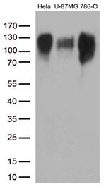 ITGB1 Antibody in Western Blot (WB)