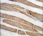 ITGB1BP3 Antibody in Immunohistochemistry (IHC)