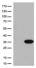 ITGB1BP3 Antibody in Western Blot (WB)