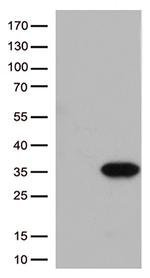 ITGB1BP3 Antibody in Western Blot (WB)