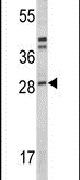 ITGB1BP3 Antibody in Western Blot (WB)