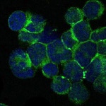 ITK Monoclonal Antibody (5G6)