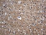 ITM2A Antibody in Immunohistochemistry (Paraffin) (IHC (P))