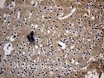 ITM2A Antibody in Immunohistochemistry (Paraffin) (IHC (P))