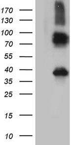 ITM2A Antibody in Western Blot (WB)