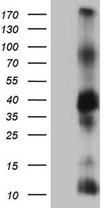 ITM2A Antibody in Western Blot (WB)