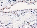 ITM2B Antibody in Immunohistochemistry (Paraffin) (IHC (P))