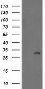 ITM2B Antibody in Western Blot (WB)
