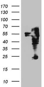 ITPK1 Antibody in Western Blot (WB)